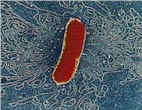 ecoli_small.jpg (23352 bytes)
